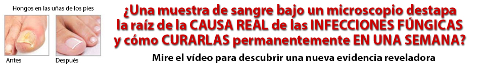 ¿Una muestra de sangre bajo un microscopio destapa la raíz de la CAUSA REAL de las INFECCIONES FÚNGICAS y cómo CURARLAS permanentemente EN UNA SEMANA?